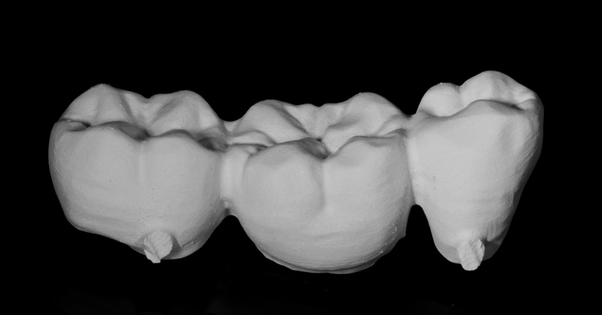ZirCAD_Prime_NARDUCCI_Abb._1a