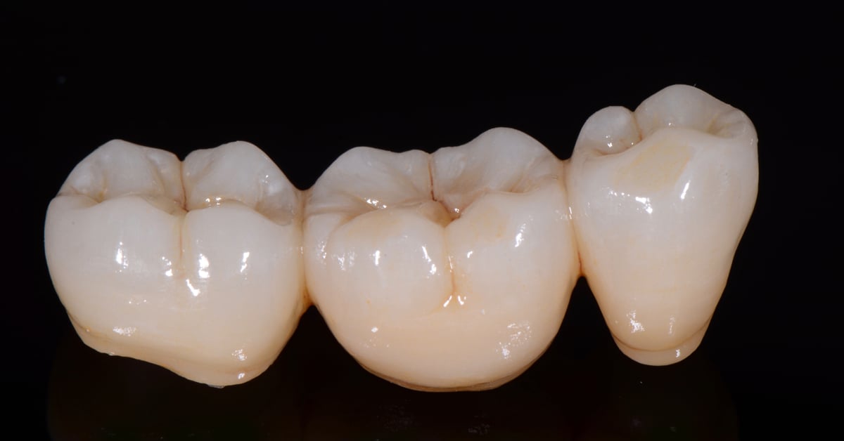 ZirCAD_Prime_NARDUCCI_Abb._1e