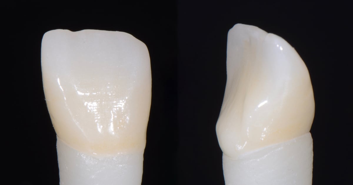ZirCAD_Prime_NARDUCCI_Abb._2d