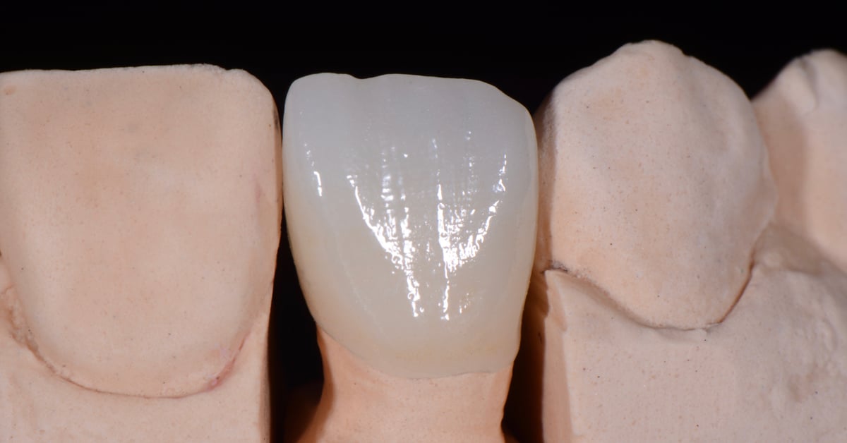 ZirCAD_Prime_NARDUCCI_Abb._2e