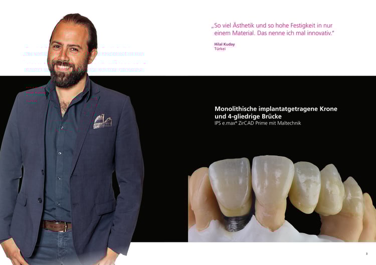 LP_ZirCAD_Prime_SPE_Hilal_Kuday_DE