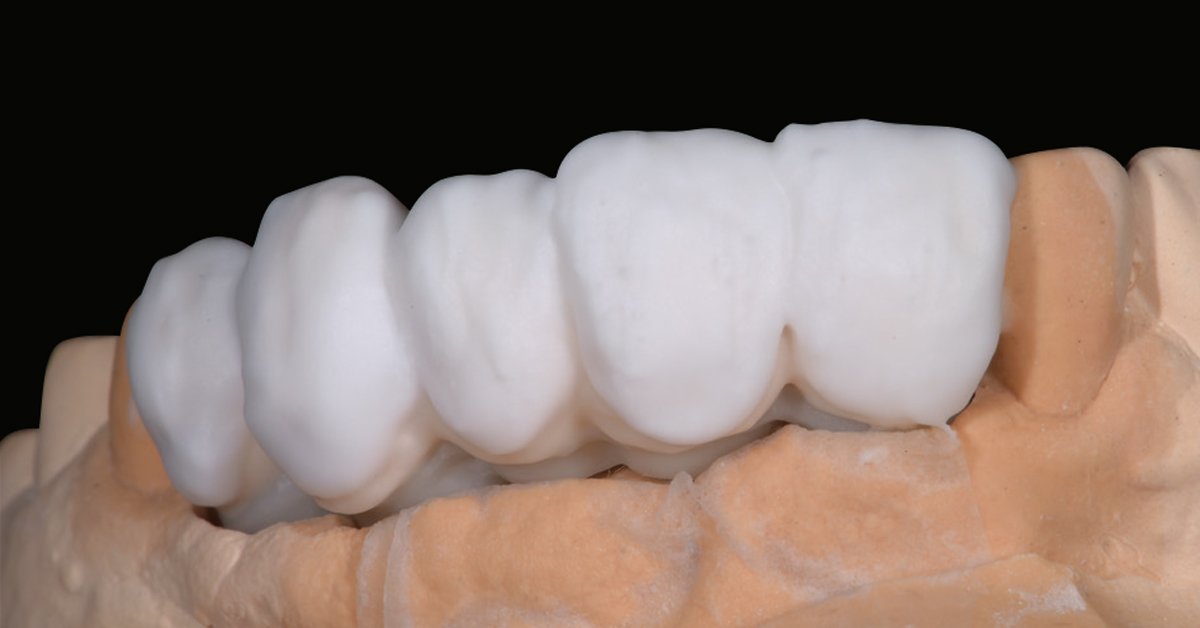 LP_ZirCAD_Prime_Fehmer_Work3
