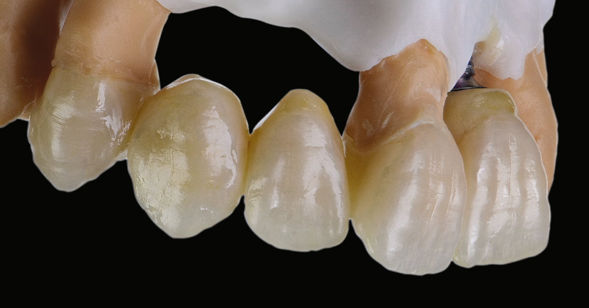 LP_ZirCAD_Prime_Kuday_Work1