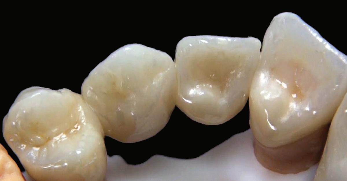 LP_ZirCAD_Prime_Kuday_Work2