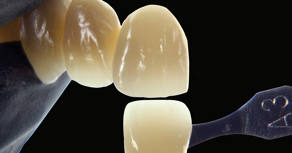 LP_ZirCAD_Prime_Kuday_Work3