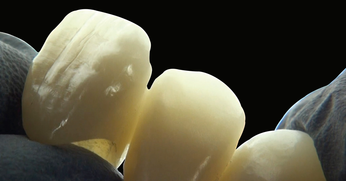 LP_ZirCAD_Prime_Kuday_Work4